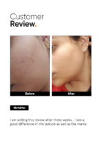 Minimalist AHA 25% + PHA 5% + BHA 2% Peeling Solution